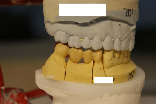 Todo el material necesario para la elaboración de prótesis dentales